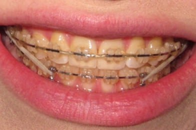 Dentist in Trivandrum – Dr. Kashi Vishwanath