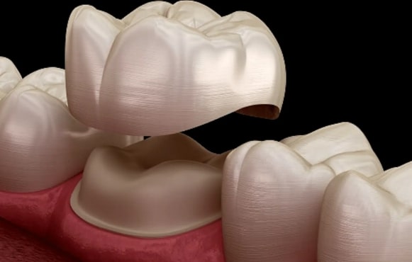 Dentist in Trivandrum – Dr. Kashi Vishwanath