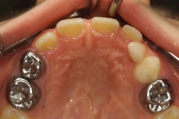 Dentist in Trivandrum – Dr. Kashi Vishwanath